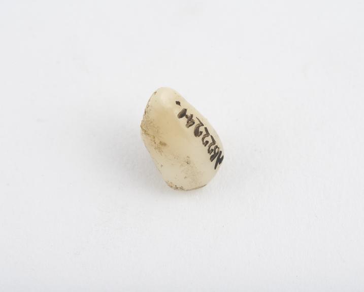 False tooth, canine, porcelain with two platinum pins, English