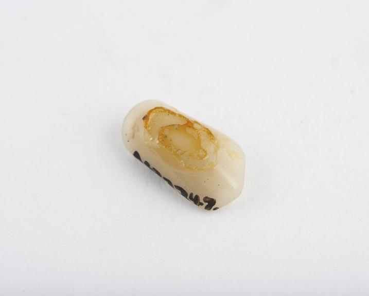 False tooth, canine, half tube