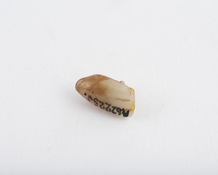 False tooth, incisor, porcelain with two platinum pins, stained