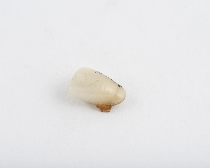 False tooth, anterior, porcelain with platinum pins, English