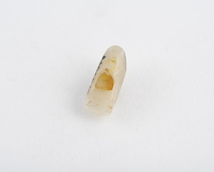 False tooth, anterior, porcelain with two pins, English