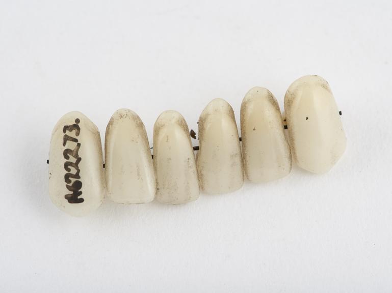 Set of 6 lower anterior diatoric teeth, porcelain, English