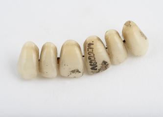 Set of false teeth