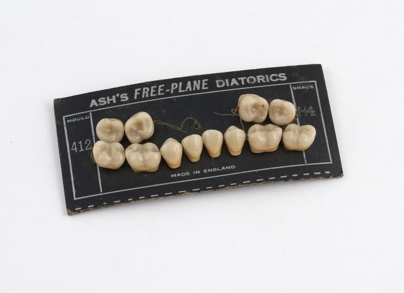 Set of upper and lower posterior diatoric teeth