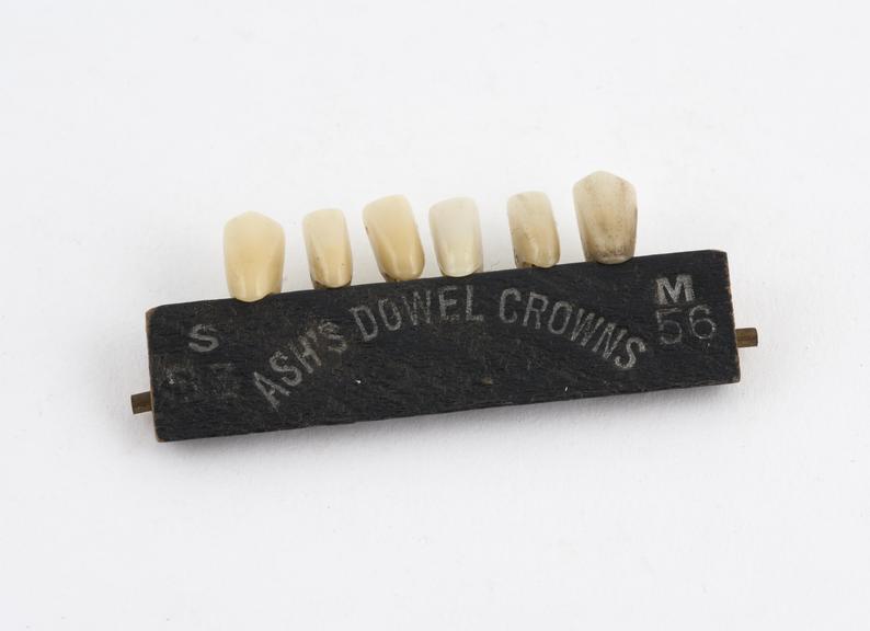 Block of 6 lower procelain anterior dowel crowns, by Ash