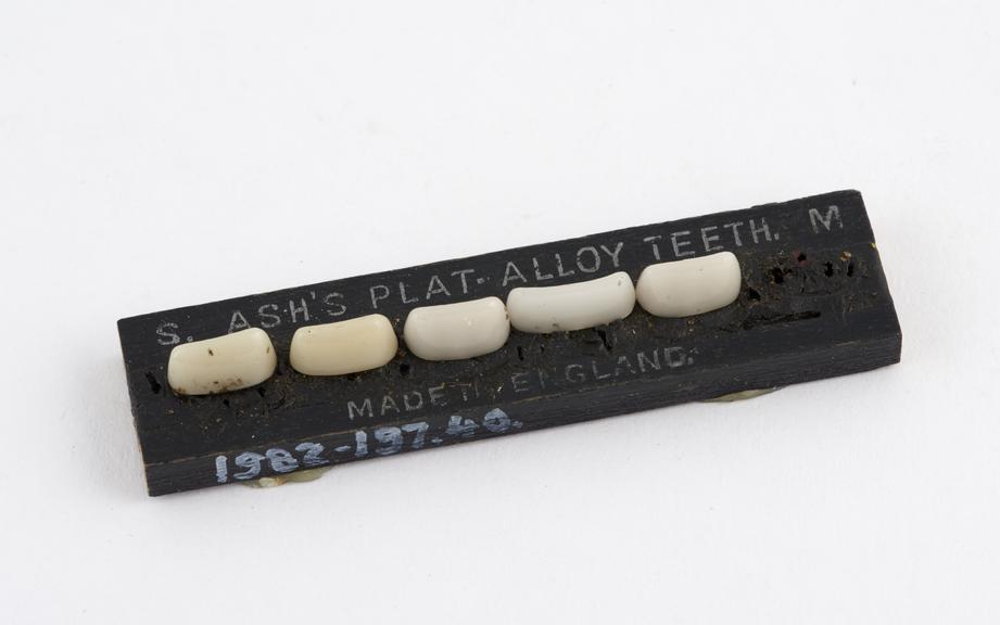 Block of Ash's platinum alloy porcelain anterior crown tips