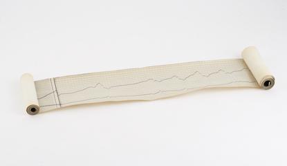 Catherization paper trace from Hansen's universal manometer