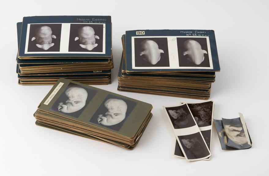 Cards of anatomical subjects and human embryo development