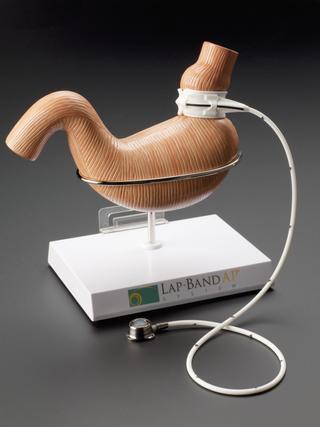 Stand and two spare syringes for gastric band "MidBand"