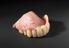 Partial upper denture