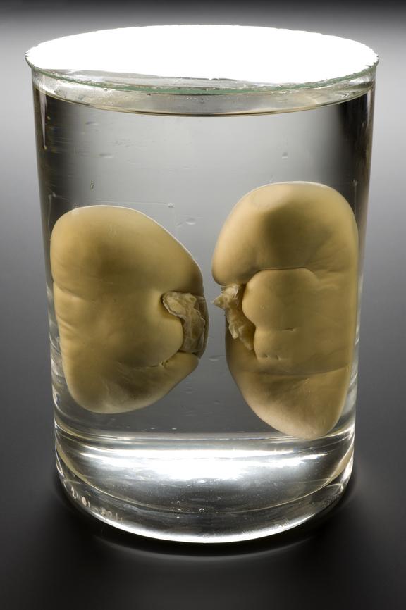 Two pig kidneys genetically engineered by Imutran Limited in