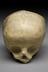 Plaster copy of the skull of the first infant delivered under