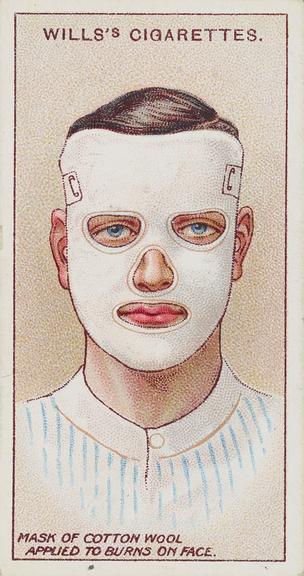 how to treat cigarette burns First Aid' cigarette card showing how to treat facial burns, England, 1915