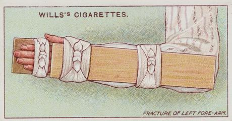 First Aid, Splint