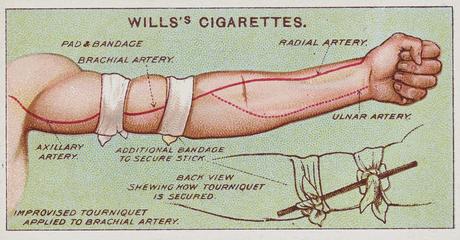 First Aid, Improvised Tourniquet