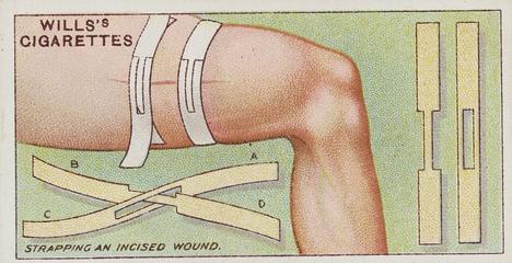 First Aid, Strapping Wound