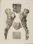 81 Anatomical prints and 62 ‘Explanation of the Plate’ pages
