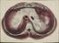 81 Anatomical prints and 62 ‘Explanation of the Plate’ pages
