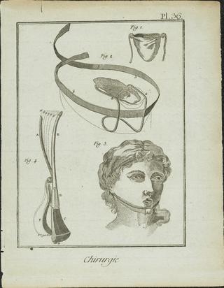 Print, engraving. Plate 36 'Chirurgie'