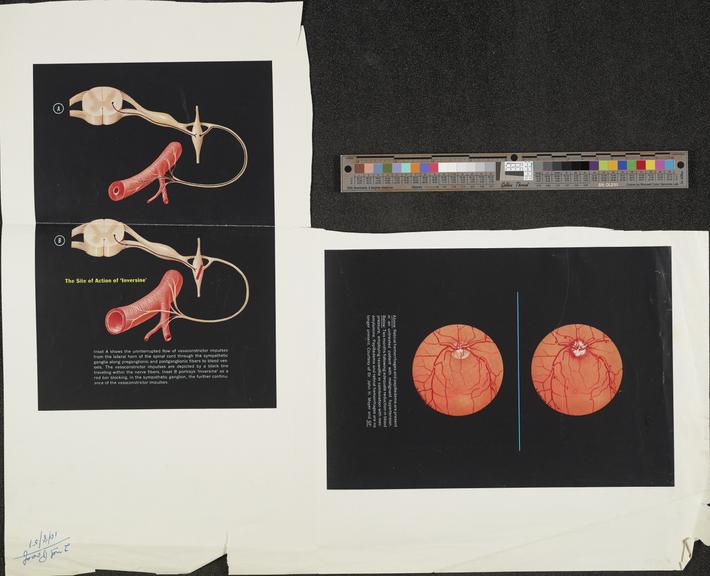 print, medical illustrations