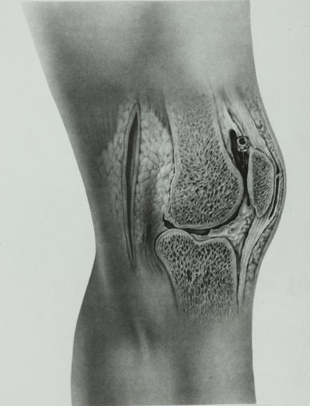 photograph, knee joint