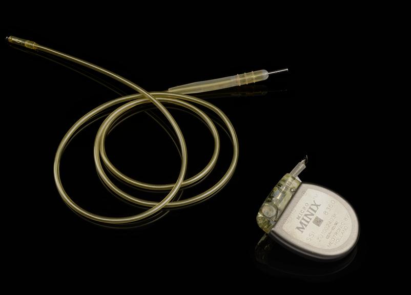 Explanted Micro-Minix™ ventricular demand pacemaker