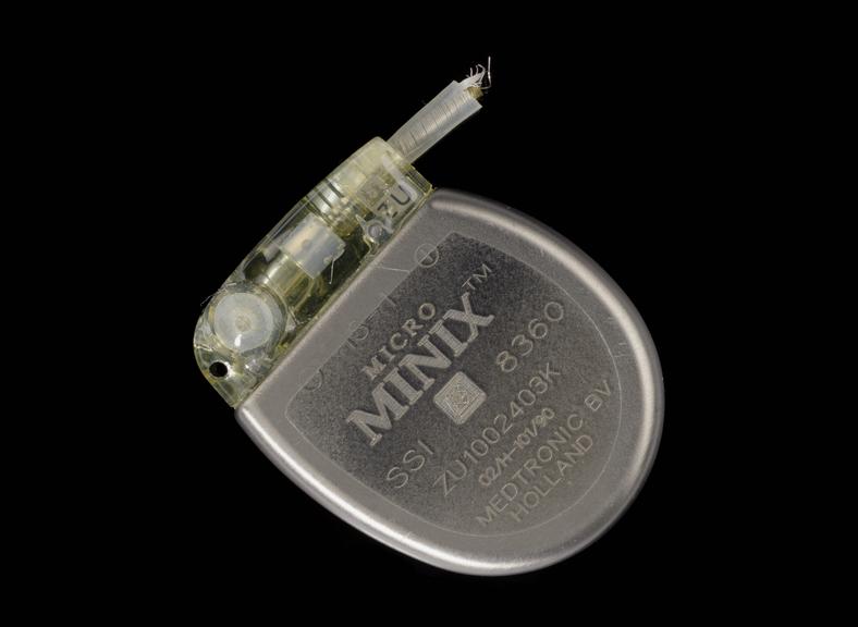 Eexplanted Micro-Minix™ ventricular demand pacemaker