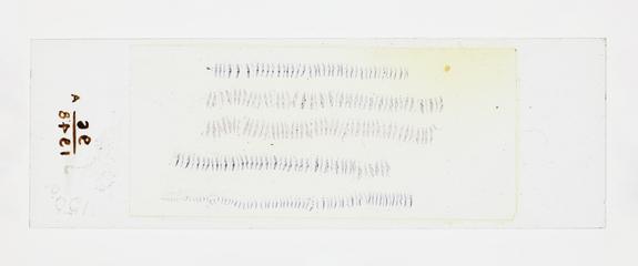 Microscope slide used in research relating to trench fever as transmitted by lice, made by F. Martin Duncan, 1918-19