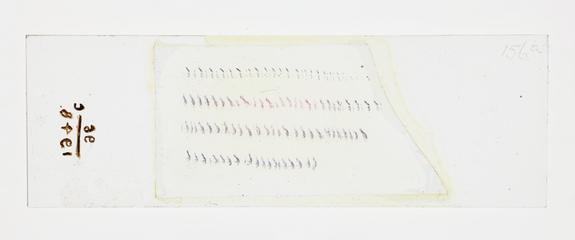 Microscope slide used in research relating to trench fever as transmitted by lice, made by F. Martin Duncan, 1918-19