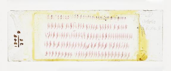 Microscope slide used in research relating to trench fever as transmitted by lice, made by F. Martin Duncan, 1918-19