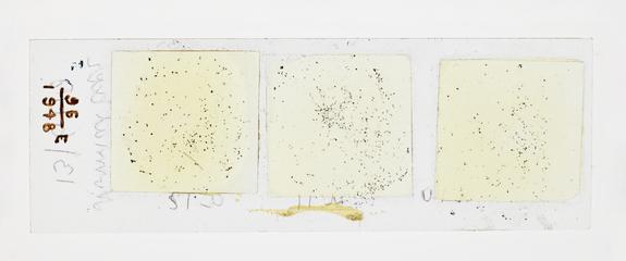 Microscope slide used in research relating to trench fever as transmitted by lice, made by F. Martin Duncan, 1918-19