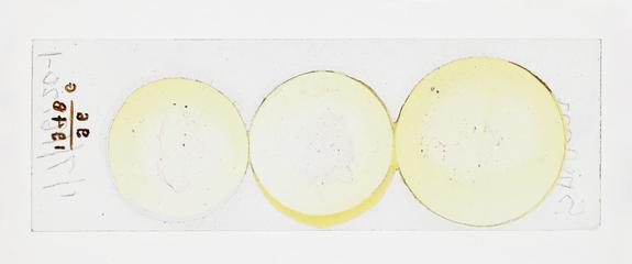 Microscope slide used in research relating to trench fever as transmitted by lice, made by F. Martin Duncan, 1918-19