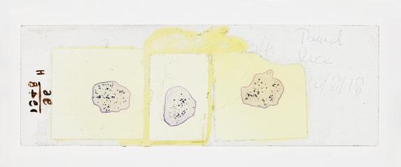 Microscope slide used in research relating to trench fever as transmitted by lice, made by F. Martin Duncan, 1918-19
