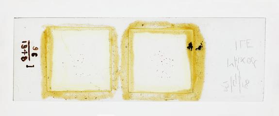 Microscope slide used in research relating to trench fever as transmitted by lice, made by F. Martin Duncan, 1918-19