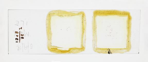 Microscope slide used in research relating to trench fever as transmitted by lice, made by F. Martin Duncan, 1918-19
