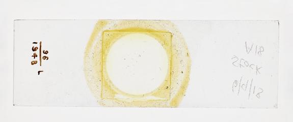 Microscope slide used in research relating to trench fever as transmitted by lice, made by F. Martin Duncan, 1918-19