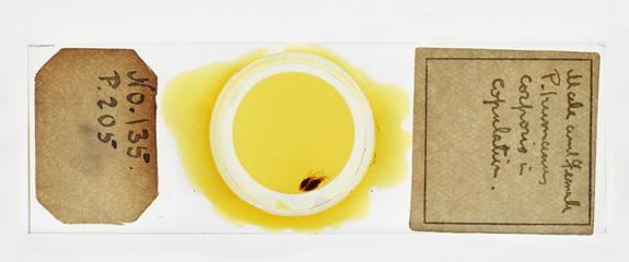 Microscope slide containing male and female lice, used in research relating to trench fever, made by F. Martin Duncan, 1918-19