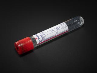 Blood collection tube