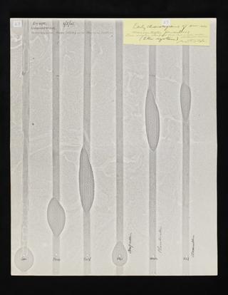 Biochromatograms showing new semisynthetic penicillins