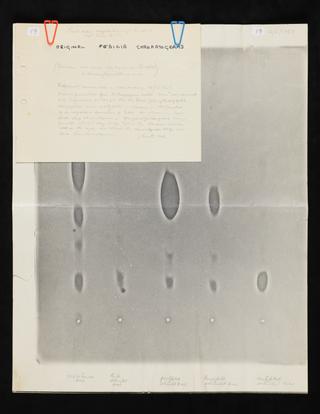 Biochromatograms showing the first ever acylation of 6-APA