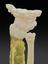 3D printed forearm, used to plan the removal of bone cancer