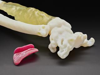 3D printed forearm, used to plan the removal of bone cancer