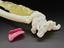 3D printed forearm, used to plan the removal of bone cancer