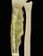 3D printed forearm, used to plan the removal of bone cancer