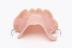 Partial upper denture