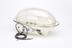 Improved portable premature neonatal incubator by Oxygenaire